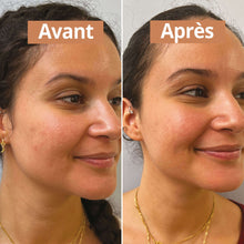 Charger l'image dans la galerie, Routine soin peaux sèches Coffret soin visage Comme Avant
